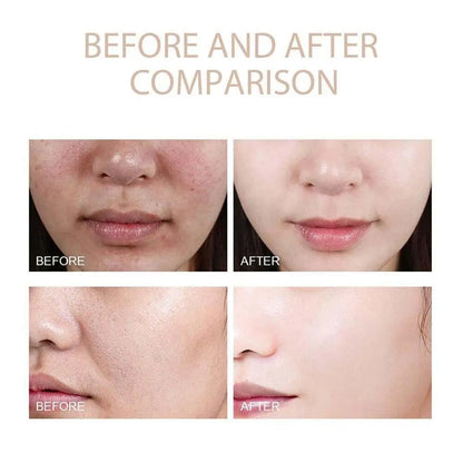 Korean Rice Exfoliating Serum - Gentle Exfoliation, Blackhead Removal, Hydrating, Pore Shrinking Skincare