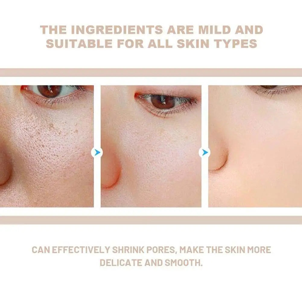 Korean Rice Exfoliating Serum - Gentle Exfoliation, Blackhead Removal, Hydrating, Pore Shrinking Skincare