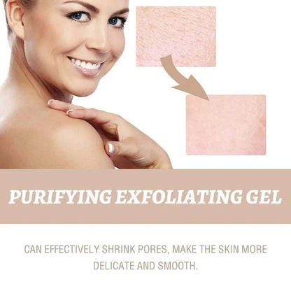 Korean Rice Exfoliating Serum - Gentle Exfoliation, Blackhead Removal, Hydrating, Pore Shrinking Skincare